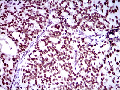 Anti-RING1 Antibody (1C89)