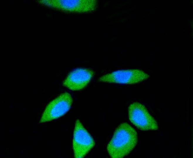 Anti-RPS3 Antibody (4S186)