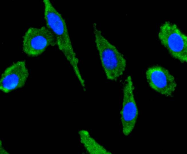 Anti-SDF-1/CXCL12 Antibody (6G646)