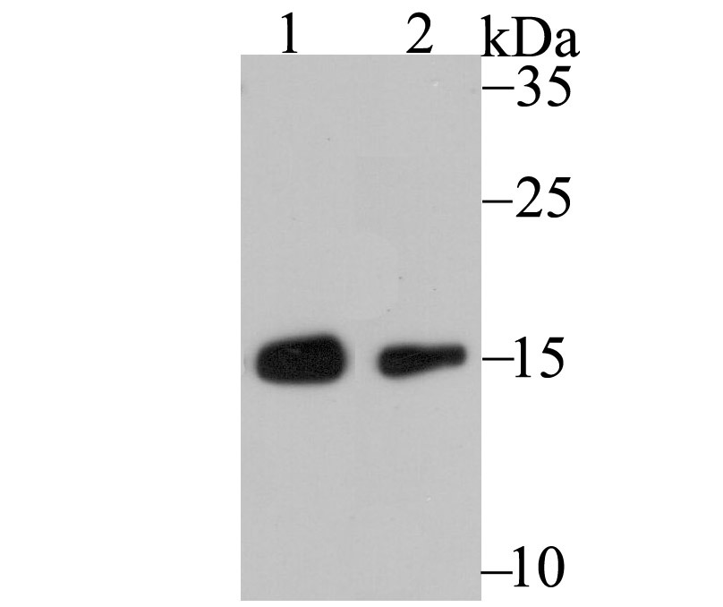 Anti-RPS19 Antibody (9D449)