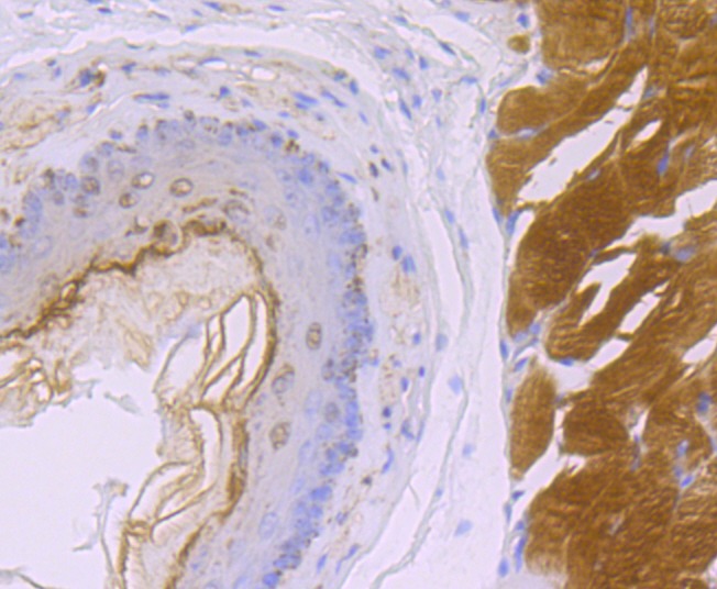 Anti-SDHB Antibody (3I144)