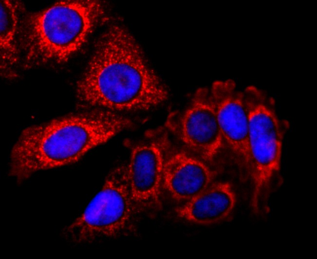 Anti-SDHA Antibody (3R603)