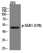 Anti-Phospho-SGK1 (Ser78) Polyclonal Antibody