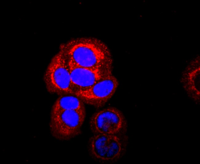 Anti-SDHA Antibody (3R603)
