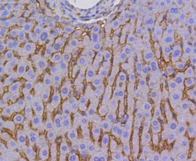 Anti-SR-BI/SCARB1 Antibody (1A957)