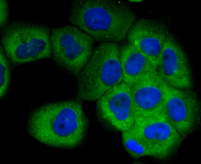 Anti-Uteroglobin Antibody (7Q840)
