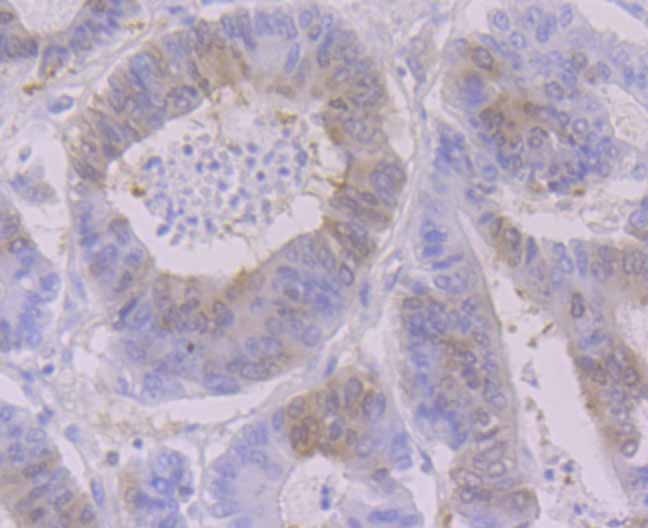 Anti-RRM1 Antibody (6Z102)