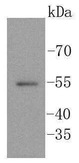 Anti-SGK1 Antibody (8M491)
