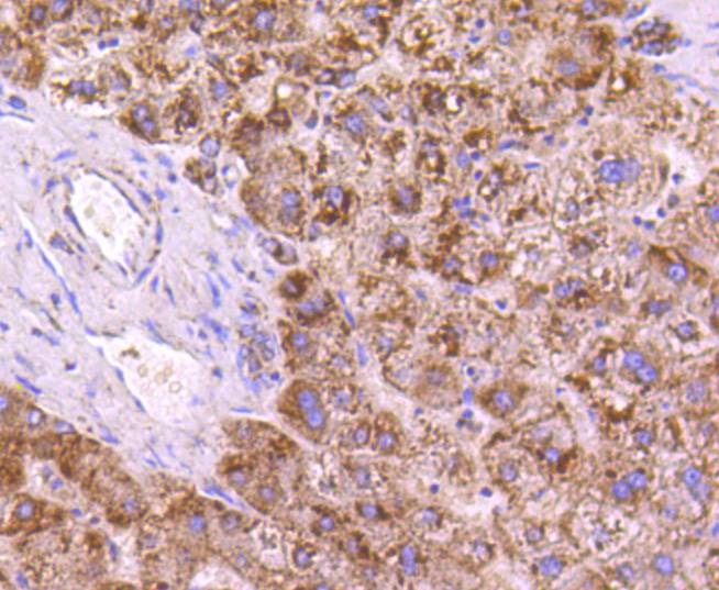 Anti-SGK1 Antibody (8M491)
