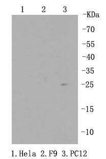 Anti-RPS3 Antibody (4S186)