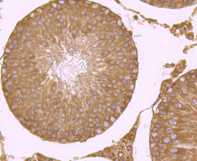 Anti-RPS19 Antibody (9D449)