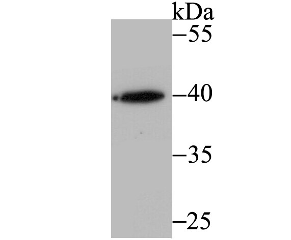 Anti-RING2 Antibody (5I450)