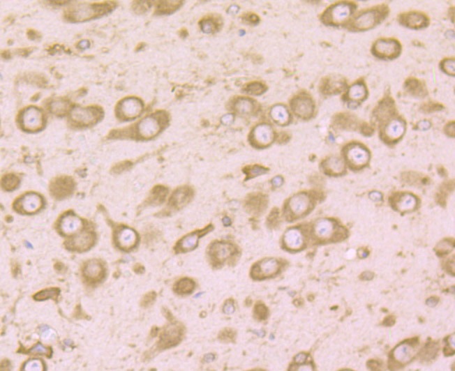 Anti-RPS19 Antibody (9D449)