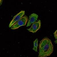 Anti-Mammaglobin-A/SCGB2A2 Antibody (6Q916)
