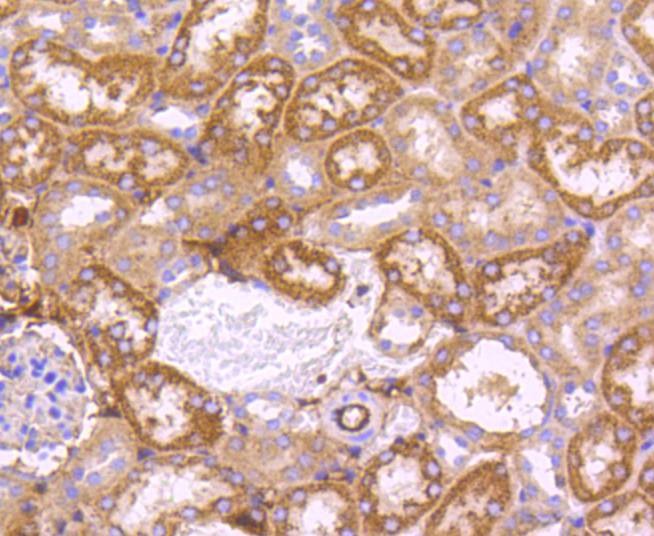 Anti-SGK1 Antibody (8M491)