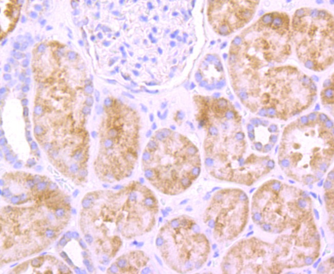 Anti-SDHA Antibody (3R603)
