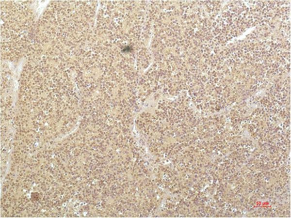 Anti-SGK1 Antibody (8Y942)