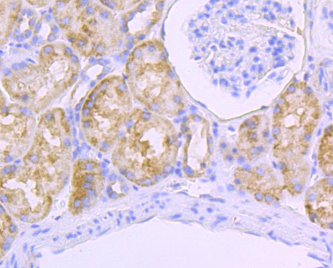 Anti-SDHB Antibody (3I144)