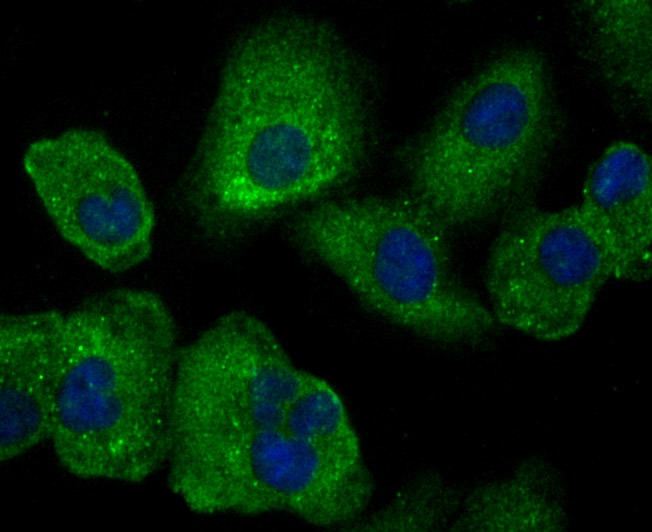 Anti-Uteroglobin Antibody (7Q840)
