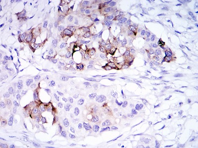 Anti-Mammaglobin-A/SCGB2A2 Antibody (6Q916)