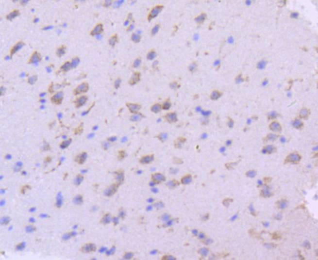 Anti-SGK1 Antibody (8M491)