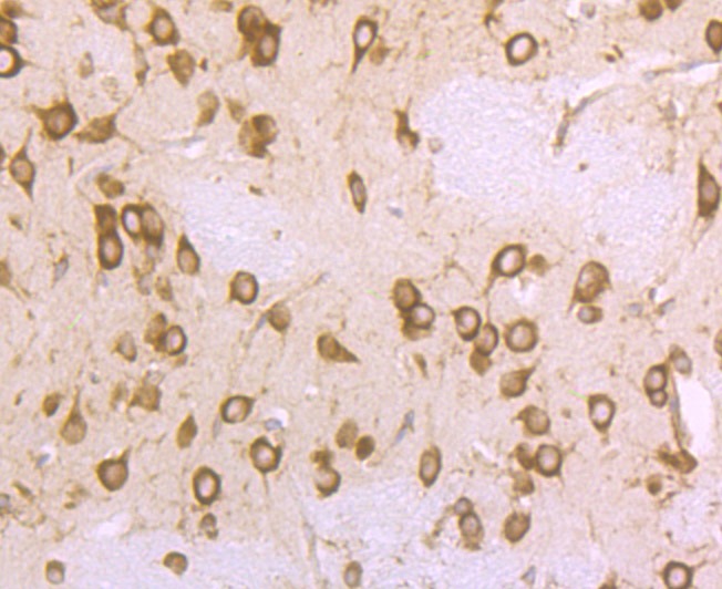 Anti-RPS19 Antibody (9D449)