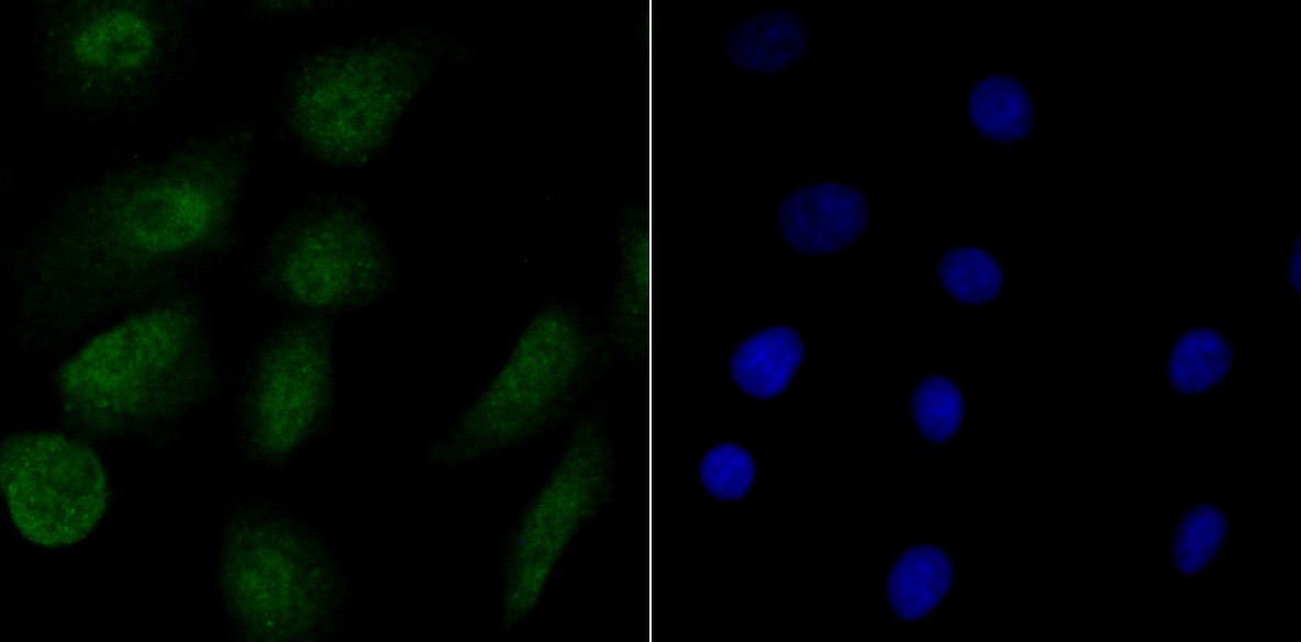 Anti-RPA1 Antibody (1L894)