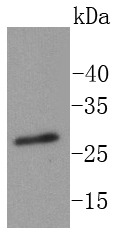 Anti-Phospho-RPA2 (Thr21) Antibody (1G657)