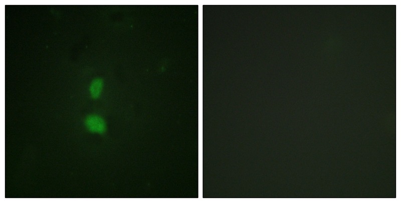 Anti-Phospho-SNAI1 (Ser246) Polyclonal Antibody 2