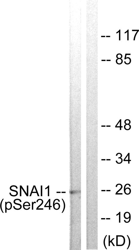 Anti-Phospho-SNAI1 (Ser246) Polyclonal Antibody 2