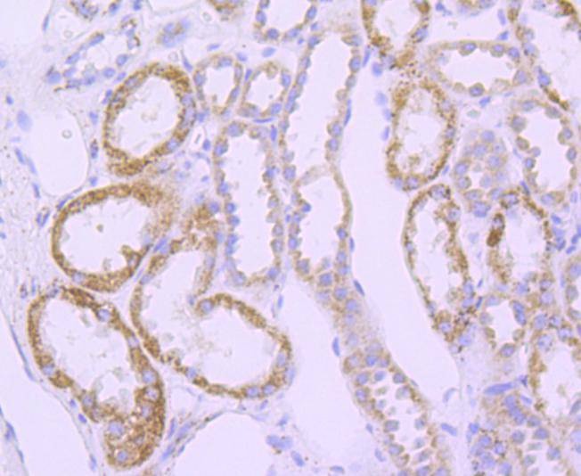 Anti-SOD2 Antibody (1Y900)