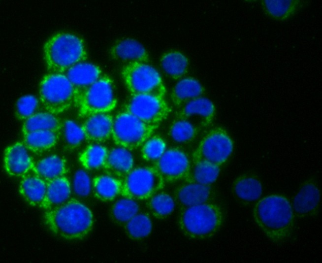Anti-SMYD3 Antibody (2M615)