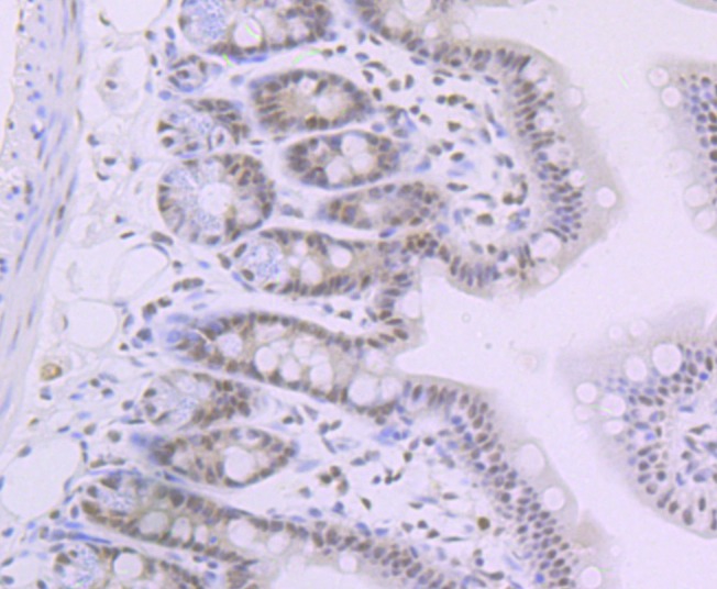 Anti-SMARCB1 Antibody (3I885)