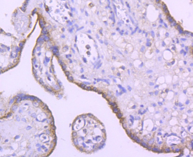 Anti-SMYD3 Antibody (2M615)