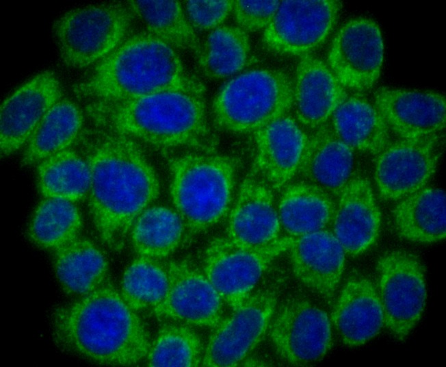 Anti-SMYD3 Antibody (2M615)
