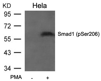 Anti-Phospho-SMAD1 (Ser206) Polyclonal Antibody