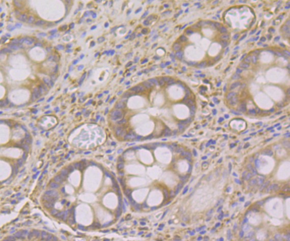 Anti-SNX1 Antibody (7Z490)