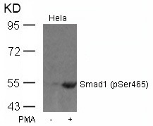 Anti-Phospho-SMAD1 (Ser465) Polyclonal Antibody