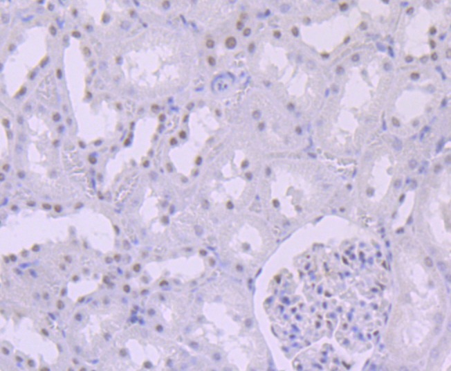 Anti-SMARCB1 Antibody (3I885)