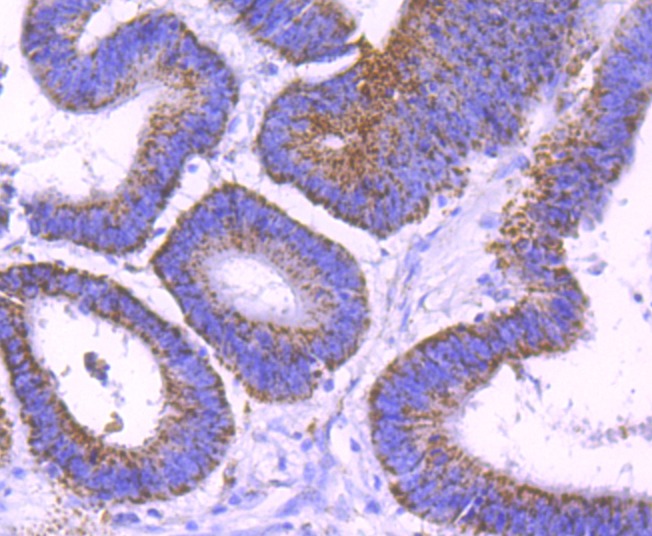 Anti-SMYD3 Antibody (2M615)