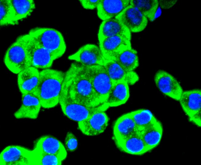Anti-RET Antibody (8T974)