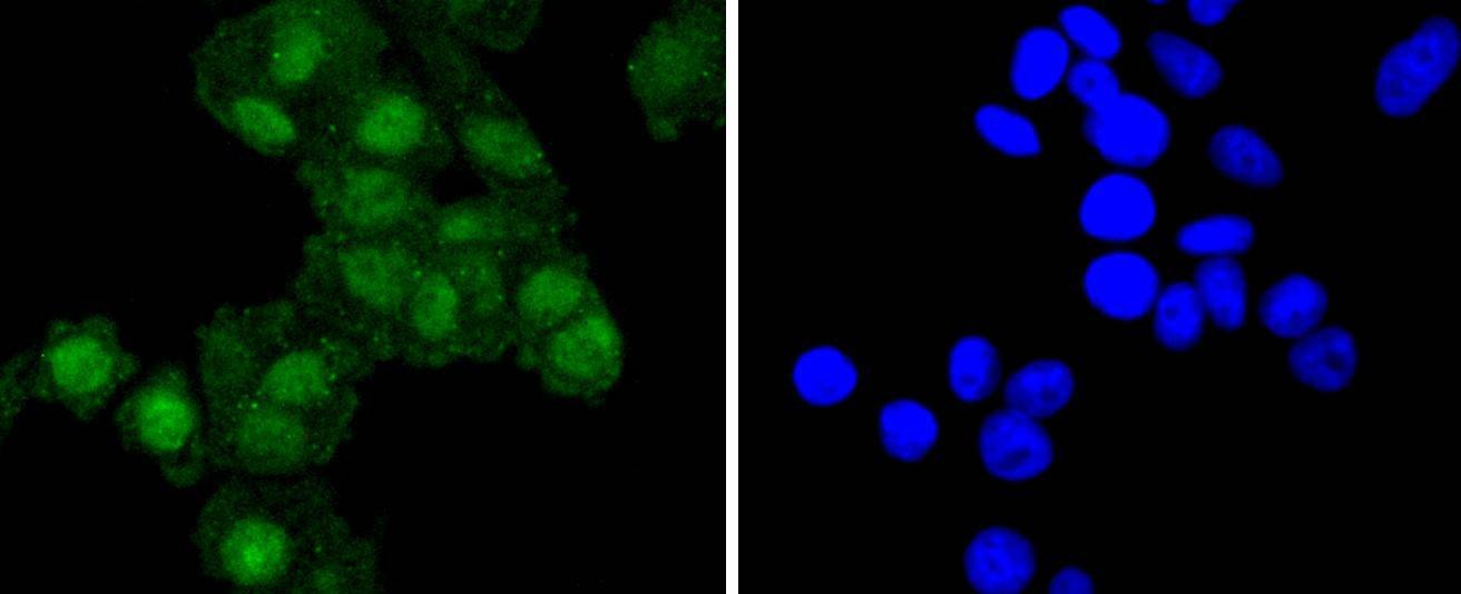 Anti-RELB Antibody (7J786)