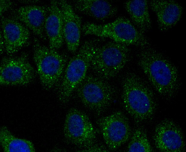 Anti-PSME1 Antibody (8P627)