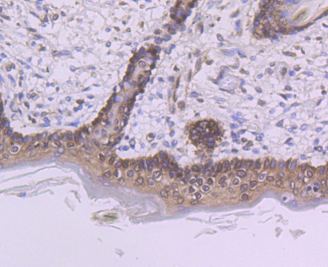Anti-PTBP1 Antibody (4Z327)
