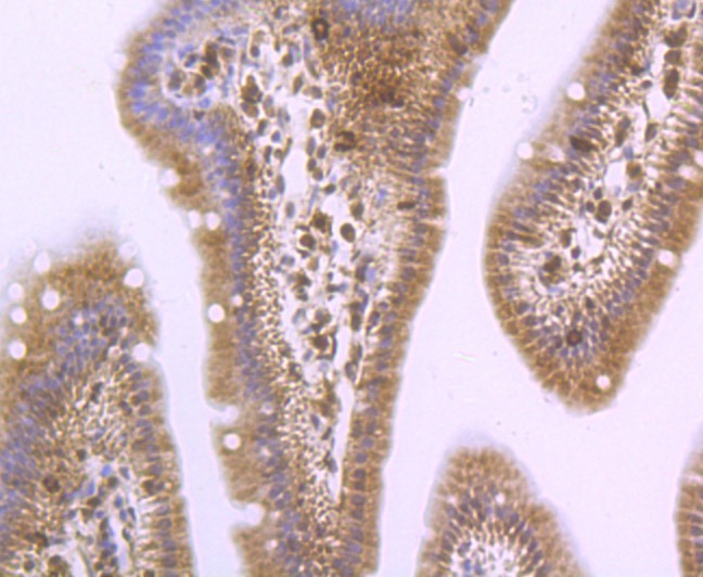 Anti-PSME1 Antibody (8P627)