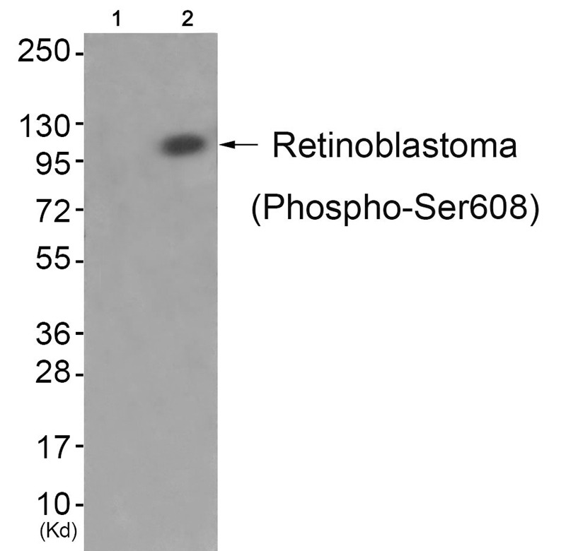 Anti-Phospho-RB1 (Ser608) Polyclonal Antibody