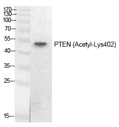 Anti-Acetyl-PTEN (Lys402) Polyclonal Antibody