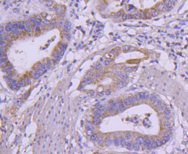 Anti-RET Antibody (8T974)