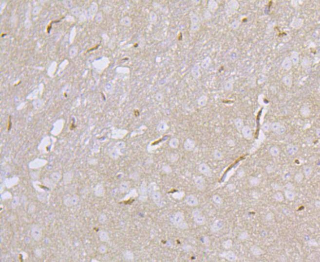 Anti-DLG4 Antibody (7K534)