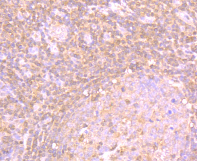 Anti-PSME1 Antibody (8P627)